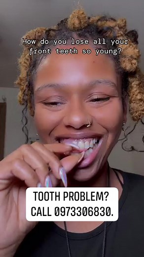 24K views · 32 reactions | When they ask how I lost all my front teeth. #howididit #teeth #dentures #denturesmile #toothdoctorzambia | Tooth Doctor Zambia | Facebook