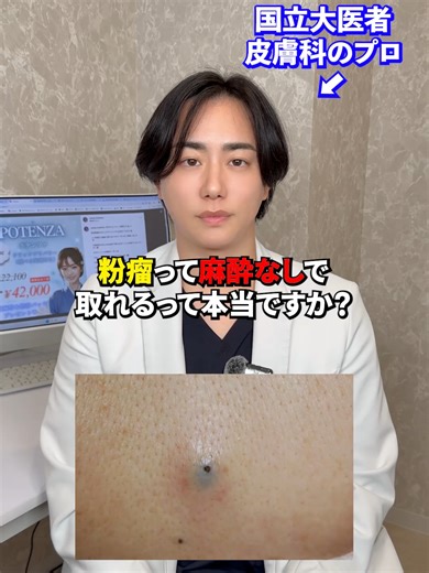 粉瘤除去手術の痛みと方法について