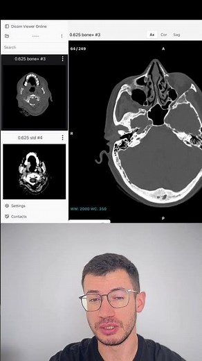 How to Embed Interactive DICOM Scans in Your Medical Blog (WordPress, Notion)