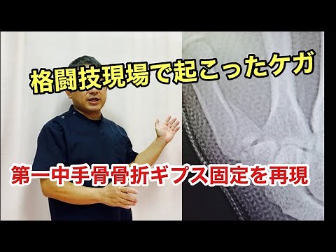 第一中手骨基部骨折ギプス固定を再現 Middle hand fracture cast fixed
