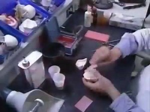 22K views · 102 reactions | Complete denture fabrication | Dento Pixels | Facebook