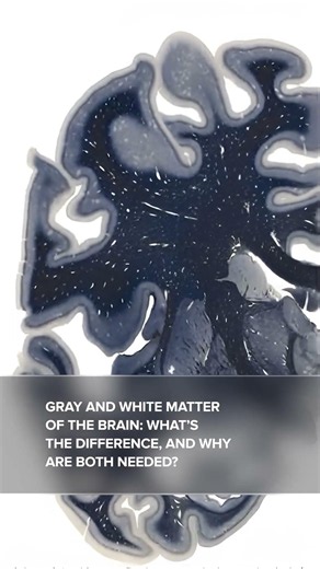 Gray and white matter of the brain: what’s the difference, and why are both needed?