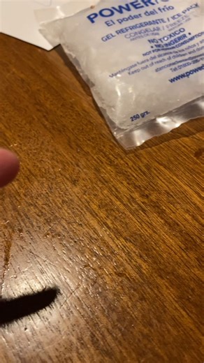 Alivio Instantáneo: Cómo Utilizar el Gel Refrigerante para Desinflamar un Dedo Dolorido