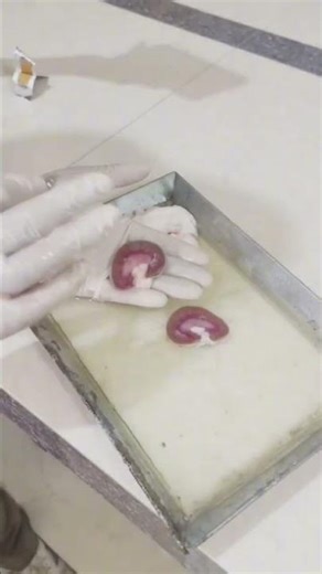 Dissection of kidney and Heart.