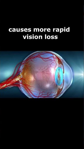 Hereditary Optic Nerve Disorders