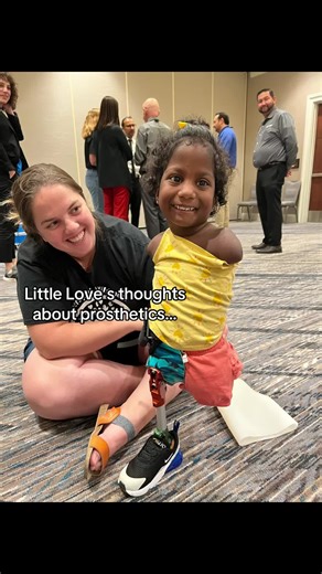 Part 1 on prosthetics from Little Love’s point of view. #prosthetic #robot #fyp #viralvideo #autonomy