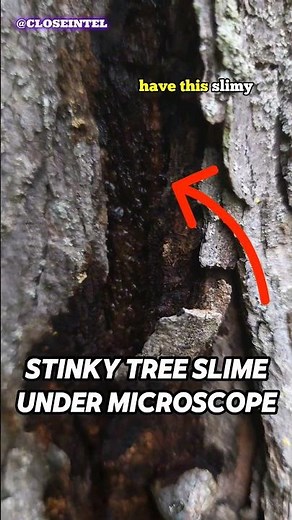 Tree Slime Under A Microscope (Bacterial Wetwood)