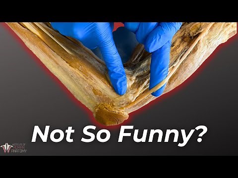 What Really Happens When You Hit Your "Funny Bone"