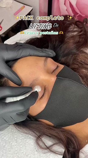 Lifting de Cejas y Pestañas: Antes y Después