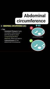 How to measure abdominal circumference on ultrasound ? #fblifestyle #radiology #medical #LoveUltrasound #ultrasound #radiologist #baby #pregnancy | Radiology Interesting Cases