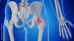 3d rendered medical animation of a man's hip joint