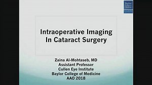 3.1K views · 65 reactions | Intraoperative Imaging for Cataract Surgery #AAO_2018 | Piece of ophthalmology | Facebook