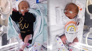Twins born at Riley Hospital marks first Twin-to-Twin Transfusion Syndrome procedure in Indiana