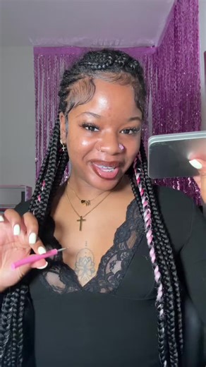 A few todayyy 💟 #extractions #satisfyingvideo #pimplepopping #acne #skintok