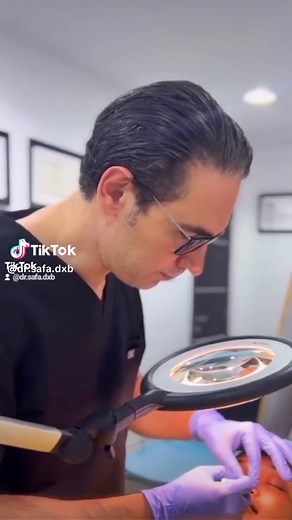 Non-Surgical Rhinoplasty. Nose Thread or HIKO Thread is a Painless procedure with Natural-looking result to enhance the Nose Bridge and Nose Contoure and to Lift the Nose Tip. It is much safer than nose filler with better result. #nosethread #nosethreads #pdonosebeforeandafter #hikonoselift