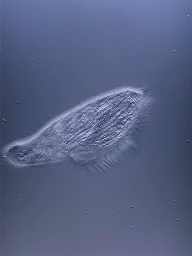 Blepharisma #microscope