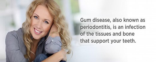 Periodontal Gum Disease Main Symptoms And Signs | Manhattan Periodontics