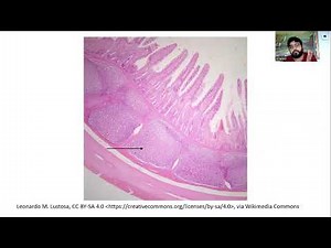 Peyer's Patches and Spleen, Immunology Lecture 7.2