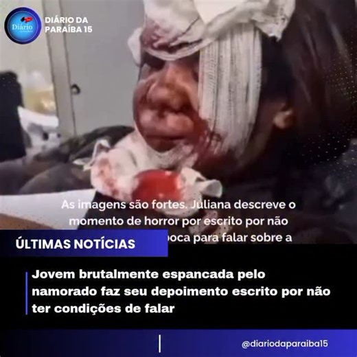 Diário da Paraíba on Instagram: "Forte: A mulher espancada pelo namorado com mais de 60 socos dentro de elevador em Natal, prestou depoimento por escrito à polícia no leito do hospital após ser socorrida no sábado (26). As imagens desfocadas mostram a jovem desfigurada e sem conseguir falar. O agente pergunta se ela consegue abrir a boca, mas ela faz sinal que não e escreve. A agressão aconteceu no sábado dentro do elevador do condomínio onde a mulher mora, em Ponta Negra, Zona Sul de Natal. O a