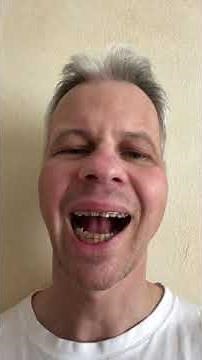 Nach OP Monat 2, Kieferchirurgie Kontrolluntersuchungen abgeschlossen