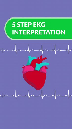 Master EKGs: 5-Step Approach for Nursing Students