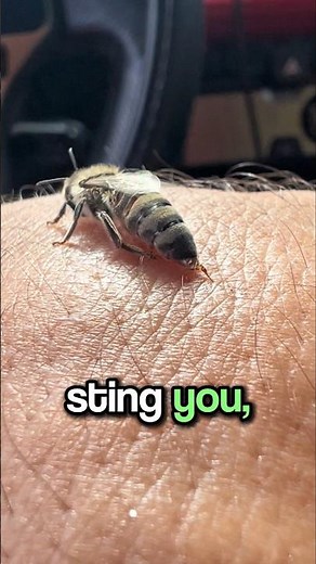 What Should You Do After a Bee Bites You? 🐝🤔