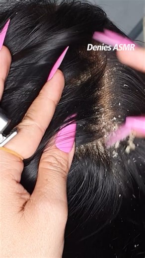 1M views · 4.3K reactions | Scalp Mic Check Every Flake, Every Scratch ASMR Realism With Beautiful Long Nails #3466 | Denies ASMR | Facebook