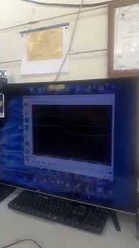 ford focus abs wheel speed sensor waveform