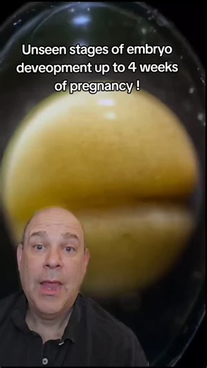 106K views · 6.7K reactions | unseen stages of embryo development up to 4 weeks This cant be seen in a human so this is a salamander development an older famous video #embryo #pregnancy #infertility #IVF #ttc #Reels #Reel #reelsvideo #reelsviral #reelsfb #reelsinstagram | Steven Palter | Facebook