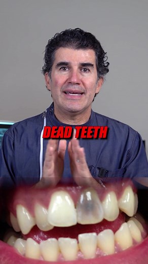 Understanding Dead Teeth: Causes, Symptoms, and Treatment Options