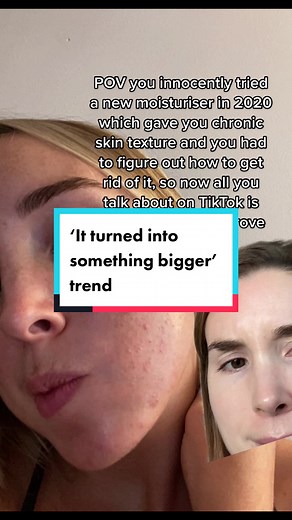 Skin Texture Improvement Tips and Routine for Clear Skin