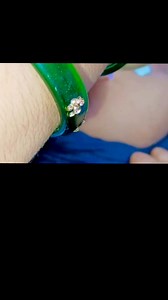 8.7K views · 190 reactions | im injection video -... | medical knowledge | Facebook