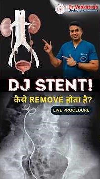 DJ Stent Removal: Live Procedure, Pain & Recovery Explained by Urologist Dr. Venkatesh Kumar
