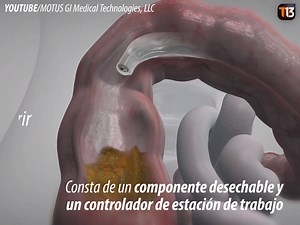 374K views · 3K reactions | Una fácil forma de limpiar el colon... | T13 | Facebook
