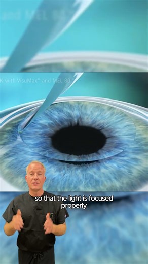How LASIK Works