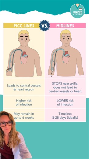 Central venous catheters, PICC lines, and Midlines…oh my! 喝Do you know the differences? This is core content to know as a nursing student & in clinical practice! #nursingcontent #nursesoftiktok #nursingeducation #PICC #clinicals #nursingstudents #nursingschool #greenscreen | Bianca RN | Facebook