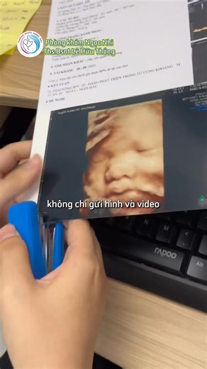 IN ẢNH 3D/4D EM BÉ TẠI PHÒNG KHÁM NGỌC NHI 😊😊😊 CỤC VÀNG NÀO ĐÃ NHẬN ĐƯỢC QUÀ RỒI NÀO 😙😙 Lưu ý: Chương trình dành tặng cho khách quen tại phòng khám nhé 😉. Khách tới khám lần đầu có nhu cầu in ảnh bé xinh thì phòng khám xin phụ thu thêm 50 cá 🥰 ———————— 📹 Tiktok: https://www.tiktok.com/@uncle_thang?_t=ZS-8yt4OsLg1S6&_r=1 📞Zalo đặt lịch: 0383327141 Nguồn: Bs Lê Hữu Thắng #phongkhamngocnhi #bslehuuthang | Phòng Khám Ngọc Nhi - BS Lê Hữu Thắng