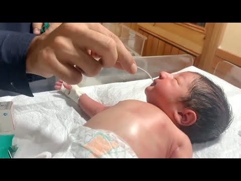 Gentle Mouth Suctioning for Newborn 👶🤍