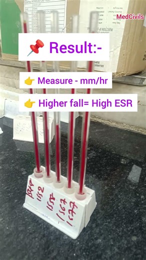 👉ESR Test Explained in 20 Seconds 🔥 | Inflammation Blood Test | Normal Values + Causes I #ytshorts