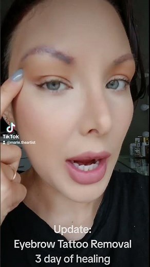 3 Day of healing from my eyebrow tattoo removal from Pico Laser.‪@EvolvetattooremovalSanDiego‬