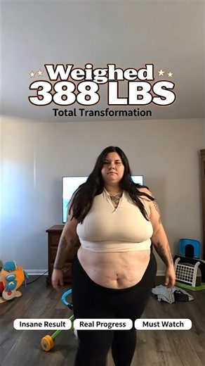 Gastric Sleeve Time-Lapse: From 388 LBS To 175 LBS! Absolute Life Saver ✨👑 #motivation