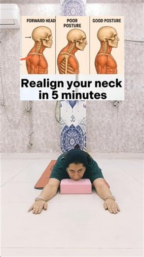 5 minutes a day to fix forward head posture and dowager's hump! #hunchback