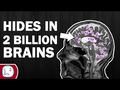 3 Common Human Parasites That Might Live Inside You