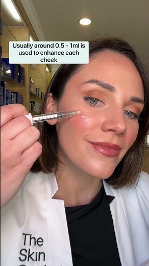How much cheek filler is used in the cheeks? 💉