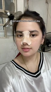 416K views · 1.4K reactions | Cast and suture removal. Late upload Doc Jess Versa Aesthetics #versafied | Mariah Clare Panganiban | Facebook