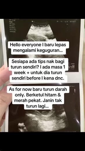 Understanding Miscarriage: Causes and Recovery Tips