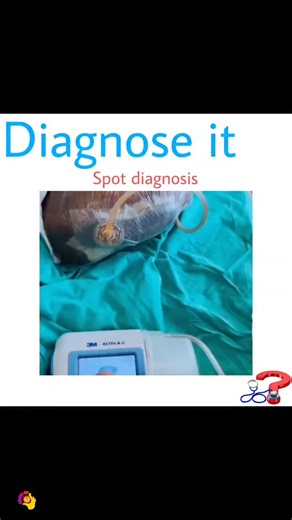 Dr Harsh Duhan on Instagram: "🩺 Test Your Diagnostic Skills! 🔍 Think you can crack today’s case? Drop your guess below ⬇️ 💬 Comment "Details" to get the complete answer delivered straight to your inbox! 📚 Want 178+ real clinical cases with explanations? Grab our Case Series eBook—perfect for NEET PG, INICET, USMLE & more! DM @diagnose_it to get yours. 🚨 Giveaway Alert! Share this post in your stories + tag us for a chance to WIN a free Case Series eBook! 🎉 👥 Tag your smartest friend and s