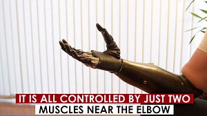 Here is the world's most advanced prosthetic limb... | Fella