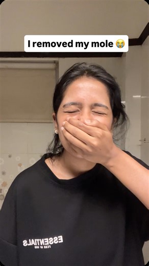 Afriyna Ashraf on Instagram: "I wanted to share this with you all because I felt like it’s a major change in my look! 🫠❤️ This procedure costed me around 3000 rupees and its called CO2 laser small mole removal. It was not that painful and was a small procedure. (In case anyone wanted to know ❤️)"