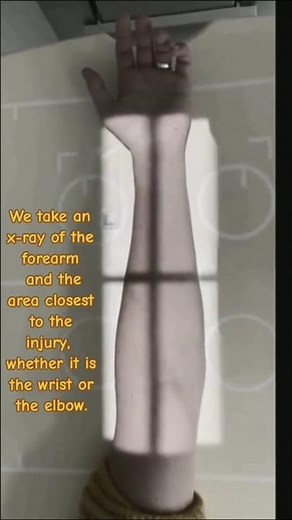 Forearm AP # Forearm Lateral # Forearm PA view X-ray patient Positioning #radiography #xrayclasses